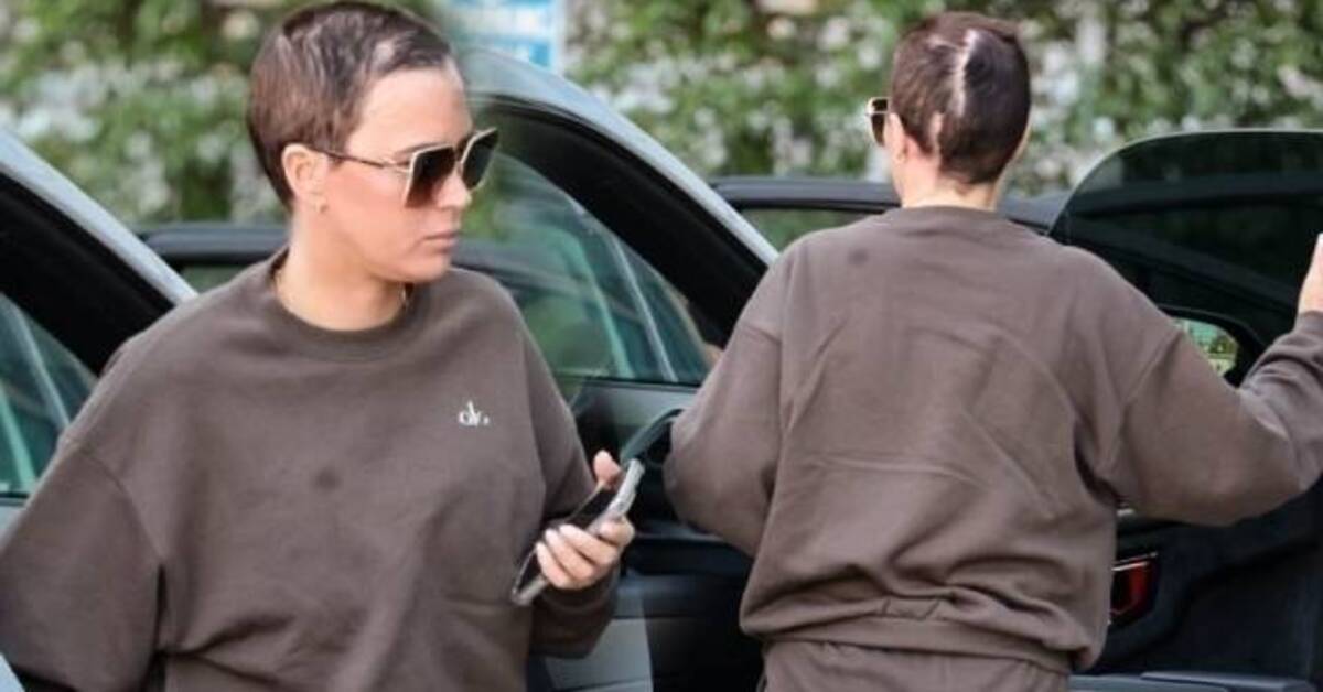 Teddi Mellencamp beyin ameliyatı izleriyle ilk kez görüntülendi